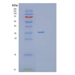 Recombinant Human PRPS2 Protein,Recombinant Human PRPS2 Protein