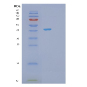 Recombinant Human PSAT1 Protein,Recombinant Human PSAT1 Protein