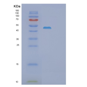 Recombinant Human PSG1 Protein,Recombinant Human PSG1 Protein