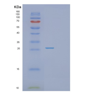 Recombinant Human PSMA2 Protein,Recombinant Human PSMA2 Protein