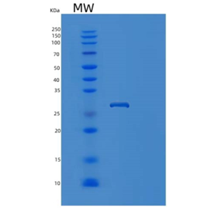 Recombinant Human PSMA7 Protein,Recombinant Human PSMA7 Protein