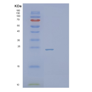 Recombinant Human PSMB2 Protein