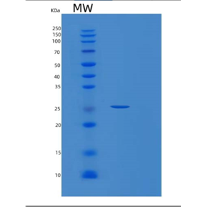 Recombinant Human PSMB5 Protein,Recombinant Human PSMB5 Protein