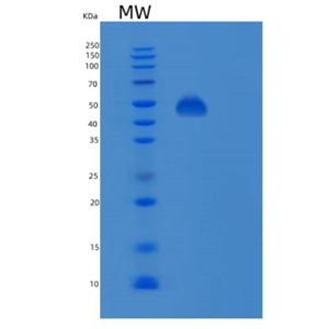 Recombinant Human PSMD11 Protein