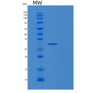 Recombinant Human PSMG2 Protein,Recombinant Human PSMG2 Protein