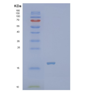 Recombinant Human PTRHD1 Protein,Recombinant Human PTRHD1 Protein