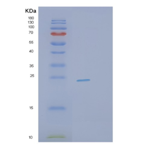 Recombinant Human PTTG1 Protein