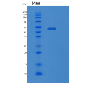 Recombinant Human QTRTD1 Protein