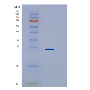 Recombinant Human RAB22A Protein