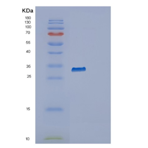 Recombinant Human RAB34 Protein,Recombinant Human RAB34 Protein