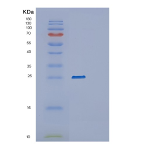 Recombinant Human RAB35 Protein,Recombinant Human RAB35 Protein