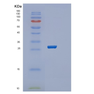 Recombinant Human RAB39B Protein