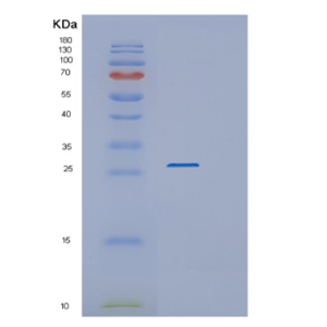 Recombinant Human RAB3B Protein,Recombinant Human RAB3B Protein