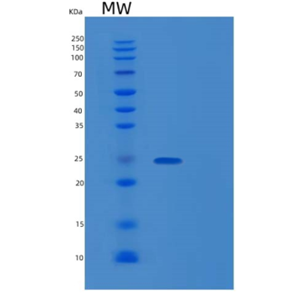 Recombinant Human RANBP1 Protein,Recombinant Human RANBP1 Protein