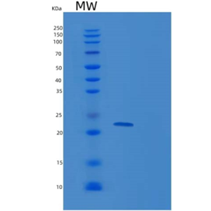 Recombinant Human RAP2B Protein,Recombinant Human RAP2B Protein