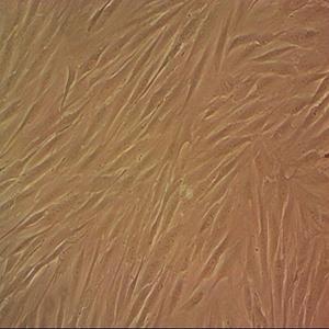 HMSC人骨髓间充质干细胞