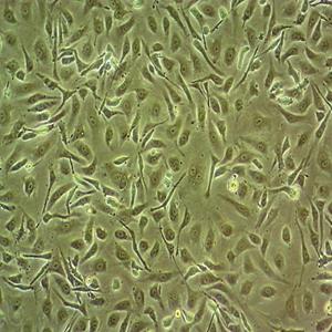 MEC-1人慢性淋巴细胞