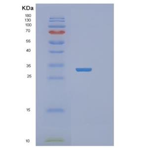 Recombinant Human RASD2 Protein