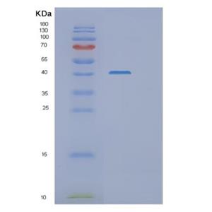 Recombinant Human RASSF1A Protein