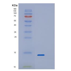 Recombinant Human RPAIN Protein,Recombinant Human RPAIN Protein