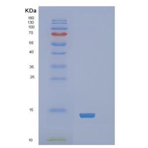 Recombinant Human RARα Protein,Recombinant Human RARα Protein