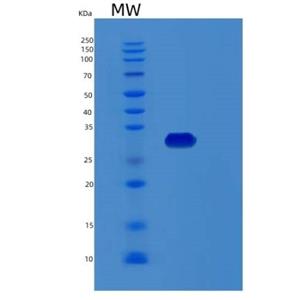 Recombinant Human RCHY1 Protein,Recombinant Human RCHY1 Protein