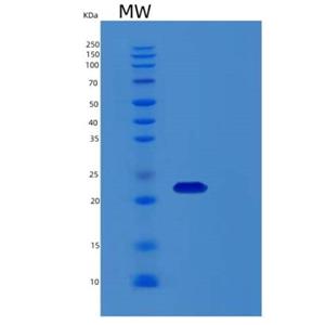 Recombinant Human Recoverin Protein