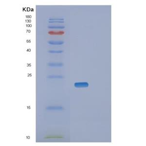 Recombinant Mouse Retinol-binding protein 4 Protein