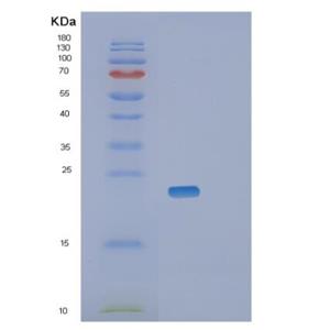 Recombinant Mouse Retinol-binding protein 4 Protein,Recombinant Mouse Retinol-binding protein 4 Protein