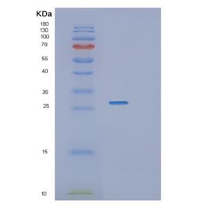 Recombinant Human RGS1 Protein