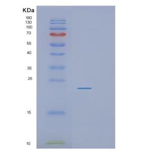 Recombinant Human RGS10 Protein