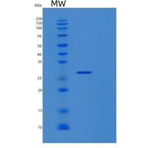 Recombinant Human RGS19 Protein