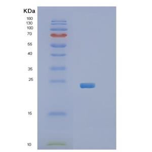 Recombinant Human RGS5 Protein,Recombinant Human RGS5 Protein