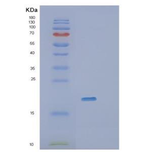 Recombinant Human RheB Protein,Recombinant Human RheB Protein