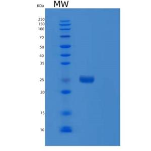 Recombinant Human RND1 Protein,Recombinant Human RND1 Protein