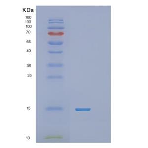 Recombinant Human RNF7 Protein,Recombinant Human RNF7 Protein