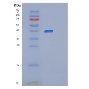 Recombinant Human RNLS Protein,Recombinant Human RNLS Protein