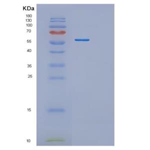 Recombinant Human RNMT Protein