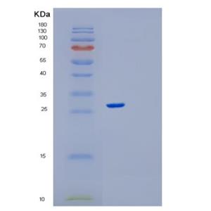 Recombinant Human RPE Protein,Recombinant Human RPE Protein