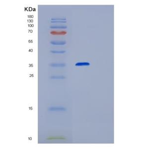 Recombinant Human RPIA Protein,Recombinant Human RPIA Protein