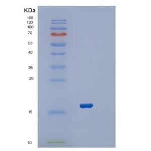 Recombinant Human RPL22 Protein,Recombinant Human RPL22 Protein