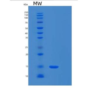 Recombinant Human RPL30 Protein,Recombinant Human RPL30 Protein