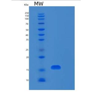 Recombinant Human RPL31 Protein,Recombinant Human RPL31 Protein