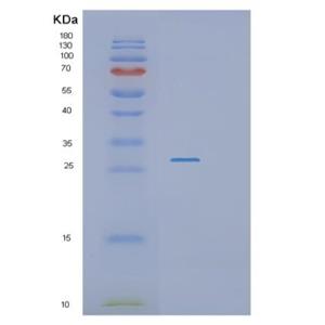 Recombinant Human RASSF3 Protein