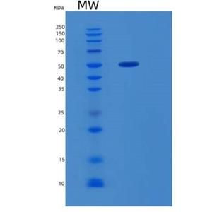 Recombinant Human RBBP4 Protein