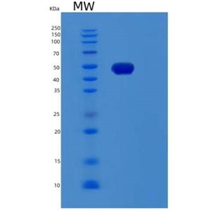 Recombinant Human RDBP Protein,Recombinant Human RDBP Protein