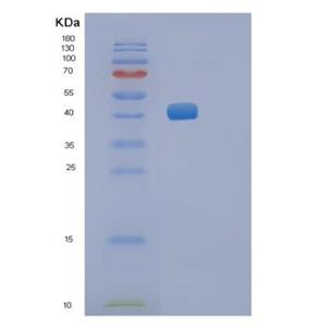 Recombinant Mouse Renin-1 Protein