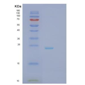 Recombinant Human RCAN2 Protein,Recombinant Human RCAN2 Protein
