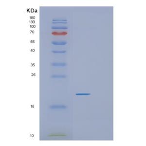 Recombinant Human RGS21 Protein