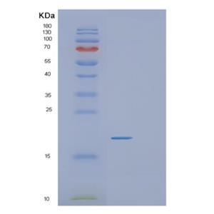 Recombinant Human RGS21 Protein,Recombinant Human RGS21 Protein